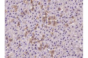 Immunohistochemistry (Paraffin-embedded Sections) (IHC (p)) image for anti-Neurotrophic Tyrosine Kinase, Receptor, Type 1 (NTRK1) (AA 101-200) antibody (ABIN1715057)