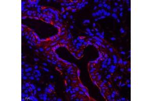 Immunofluorescence of paraffin embedded rat ovary using NRG2 (ABIN7074804) at dilution of 1: 500 (400x lens) (Neuregulin 2 抗体)