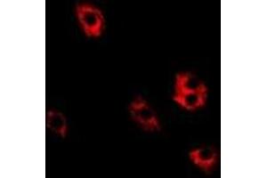 Immunofluorescent analysis of SRP19 staining in Hela cells. (SRP19 抗体)