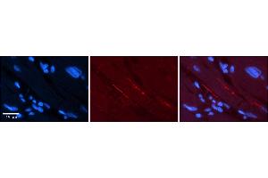 Immunohistochemistry (IHC) image for anti-Sodium Channel, Voltage-Gated, Type V, alpha Subunit (SCN5A) (N-Term) antibody (ABIN2776088)