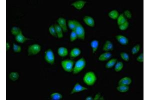 Immunofluorescent analysis of A549 cells using ABIN7144679 at dilution of 1:100 and Alexa Fluor 488-congugated AffiniPure Goat Anti-Rabbit IgG(H+L) (NAT2 抗体  (AA 1-290))