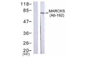 Image no. 1 for anti-Myristoylated Alanine-Rich Protein Kinase C Substrate (MARCKS) (Ser162) antibody (ABIN197518) (MARCKS 抗体  (Ser162))