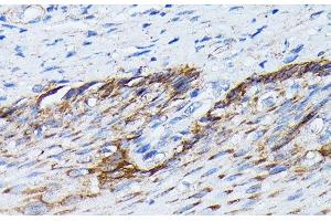 Immunohistochemistry (Paraffin-embedded Sections) (IHC (p)) image for anti-Keratin 14 (KRT14) antibody (ABIN7258338)