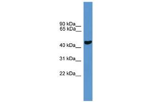 WB Suggested Anti-Park2 Antibody Titration: 0. (Parkin 抗体  (C-Term))