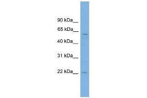 FTO antibody used at 1 ug/ml to detect target protein. (FTO 抗体  (Middle Region))