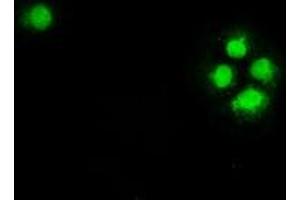 Anti-CHEK2 mouse monoclonal antibody (ABIN2452258) immunofluorescent staining of COS7 cells transiently transfected by pCMV6-ENTRY CHEK2 (RC201278). (CHEK2 抗体)