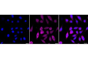 Immunocytochemical staining of HepG2 cells with P4HTM antibody (ABIN7799921), 1:1,000). (Recombinant P4HTM 抗体)
