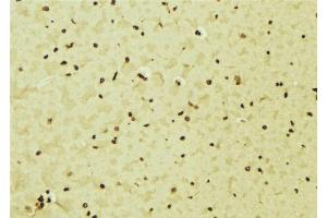 ABIN6276552 at 1/100 staining Mouse brain tissue by IHC-P. (IRF5 抗体  (C-Term))