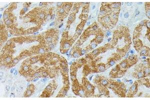 Immunohistochemistry of paraffin-embedded Mouse kidney using MEF2C Polyclonal Antibody at dilution of 1:100 (40x lens). (MEF2C 抗体)
