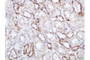Formalin-fixed and paraffin embedded human kidney labeled with Rabbit Anti-NNT Polyclonal Antibody, Unconjugated  at 1:200 followed by conjugation to the secondary antibody and DAB staining (NNT 抗体  (AA 981-1086))