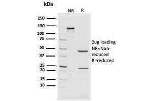 SDS-PAGE Analysis Purified CD44v4/5 Mouse Monoclonal Antibody (3D2). (CD44 抗体)