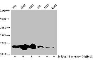 Western Blot Detected samples: 293 whole cell lysate, A549 whole cell lysate, K562 whole cell lysate, Untreated (-) or treated (+) with 30 mM sodium butyrate for 4h All lanes: HIST1H2BC antibody at 1:100 Secondary Goat polyclonal to rabbit IgG at 1/50000 dilution Predicted band size: 14 kDa Observed band size: 14 kDa (Histone H2B 抗体  (acLys20))