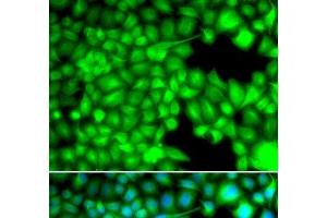 Immunofluorescence analysis of U2OS cells using FABP3 Polyclonal Antibody (FABP3 抗体)