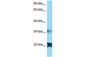 Image no. 1 for anti-NADH Dehydrogenase (Ubiquinone) 1 alpha Subcomplex, 8, 19kDa (NDUFA8) (AA 25-74) antibody (ABIN6748389) (NDUFA8 抗体  (AA 25-74))
