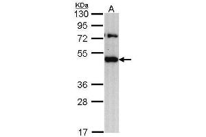 WB Image Sample (30 ug of whole cell lysate) A: H1299 10% SDS PAGE antibody diluted at 1:1000 (TRAM1 抗体  (C-Term))