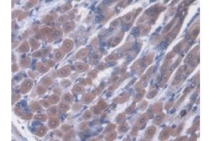 Immunohistochemistry (IHC) image for anti-Von Willebrand Factor (VWF) (AA 1498-1665) antibody (ABIN7429115)