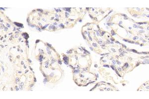 Detection of FN3K in Human Placenta Tissue using Polyclonal Antibody to Fructosamine-3-Kinase (FN3K) (FN3K 抗体  (AA 1-309))