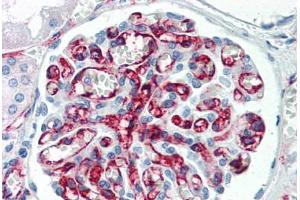 Human Kidney (formalin-fixed, paraffin-embedded) stained with PECAM1 antibody ABIN337092 at 5 ug/ml followed by biotinylated anti-mouse IgG secondary antibody ABIN481714, alkaline phosphatase-streptavidin and chromogen. (CD31 抗体)
