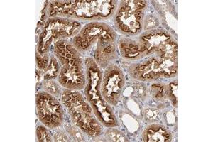 Immunohistochemical staining of human kidney with ASB8 polyclonal antibody  show strong cytoplasmic positivity in cells in tubules. (ASB8 抗体)