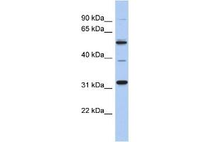 WB Suggested Anti-MGC51025 Antibody Titration: 0. (TBC1D26 抗体  (Middle Region))