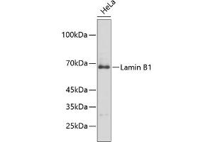 Western blot analysis of extracts of HeLa cells, using Lamin B1 antibody (ABIN1513160, ABIN3023296 and ABIN3023297). (Lamin B1 抗体)