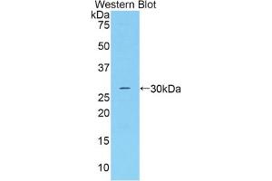 Western blot analysis of the recombinant protein. (Adipsin 抗体  (AA 1-263))