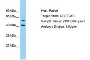 Image no. 1 for anti-DEP Domain Containing 1B (DEPDC1B) (AA 87-136) antibody (ABIN6750177) (DEPDC1B 抗体  (AA 87-136))