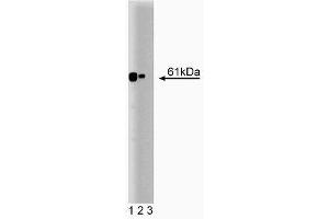 Western blot analysis of Calcineurin on a rat cerebrum lysate. (CAN 抗体  (AA 247-449))