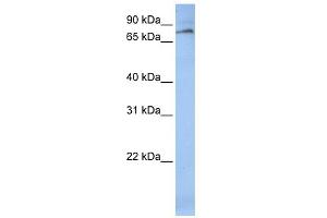 WB Suggested Anti-ALOX12 Antibody Titration: 0. (ALOX12 抗体  (C-Term))