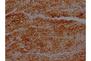 IHC image of ABIN7127460 diluted at 1:100 and staining in paraffin-embedded human heart tissue performed on a Leica BondTM system. (Recombinant Dystrophin 抗体)