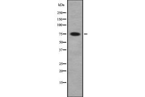 Western blot analysis of PAK5/6 using COLO whole cell lysates (PAK7 抗体  (C-Term))