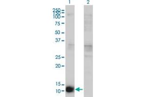 Western Blot analysis of CSTB expression in transfected 293T cell line by CSTB monoclonal antibody (M02), clone M2-F1. (CSTB 抗体  (AA 1-98))