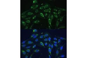Immunofluorescence analysis of U-2 OS cells using COX6 Polyclonal Antibody (ABIN6132108, ABIN6138915, ABIN6138916 and ABIN6220368) at dilution of 1:100 (40x lens). (COX6A1 抗体  (AA 25-109))