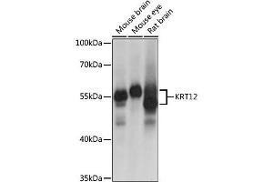 Western blot analysis of extracts of various cell lines, using KRT12 antibody (ABIN6134130) at 1:1000 dilution. (KRT12 抗体  (AA 295-494))