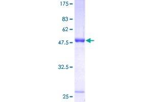 UCHL1 Protein (AA 1-223) (GST tag)