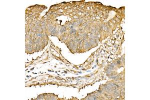 Immunohistochemistry of paraffin-embedded mouse kidney using DNA Ligase III/LIG3 Rabbit pAb (ABIN6130288, ABIN6143207, ABIN6143208 and ABIN6217532) at dilution of 1:50 (40x lens). (LIG3 抗体  (AA 730-1009))