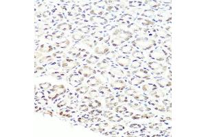 Immunohistochemistry of paraffin-embedded mouse stomach using PRPF8 antibody (ABIN5973594) at dilution of 1/100 (40x lens).