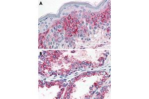 Immunohistochemical staining of formalin-fixed, paraffin-embedded human prostate (A) and human prostate (B) tissue after heat-induced antigen retrieval. (HTR2A 抗体  (N-Term))