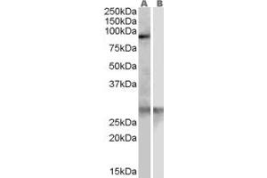 Western Blotting (WB) image for anti-Acetyl LDL Receptor (SCARF1) (Internal Region) antibody (ABIN2466320) (SCARF1 抗体  (Internal Region))