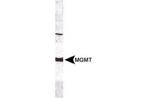 Western blot analysis of MGMT in CEM whole cell extract using MGMT monoclonal antibody, clone MT 23. (MGMT 抗体)