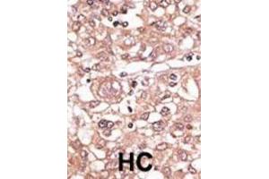 Immunohistochemistry (IHC) image for anti-Toll-Like Receptor 7 (TLR7) antibody (ABIN2998417) (TLR7 抗体)