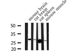 Western blot analysis of MBL2 expression in various lysates (MBL2 抗体  (N-Term))