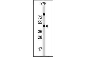 Western blot analysis of CD107a / LAMP1 Antibody (N-term) Cat. (LAMP1 抗体  (N-Term))