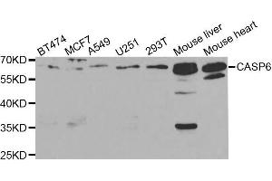 Western blot analysis of extracts of various cell lines, using CASP6 antibody. (Caspase 6 抗体  (AA 24-293))