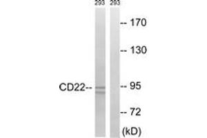 Western blot analysis of extracts from 293 cells, treated with Ca2+ 40nM 30', using BL-CAM (Ab-807) Antibody. (CD22 抗体  (AA 776-825))