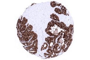 Seminal vesicle epithelial cells exhibit high level MUC6 expression (Recombinant MUC6 抗体)