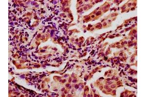 Immunohistochemistry (IHC) image for anti-Chromatin Assembly Factor 1, Subunit A (p150) (CHAF1A) (AA 840-904) antibody (ABIN7147681)