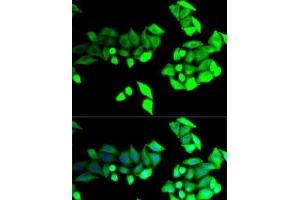 Immunofluorescence analysis of U2OS cells using BEST1 Polyclonal Antibody (Bestrophin 1 抗体)