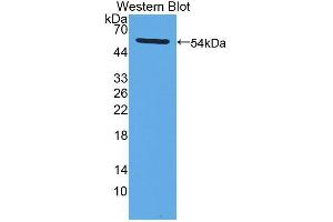 Western blot analysis of the recombinant protein. (LPCAT1 抗体  (AA 301-514))