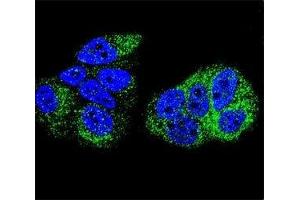 Confocal immunofluorescent analysis of HNF4A antibody with MCF-7 cells followed by Alexa Fluor 488-conjugated goat anti-rabbit lgG (green). (HNF4A 抗体  (AA 107-139))
